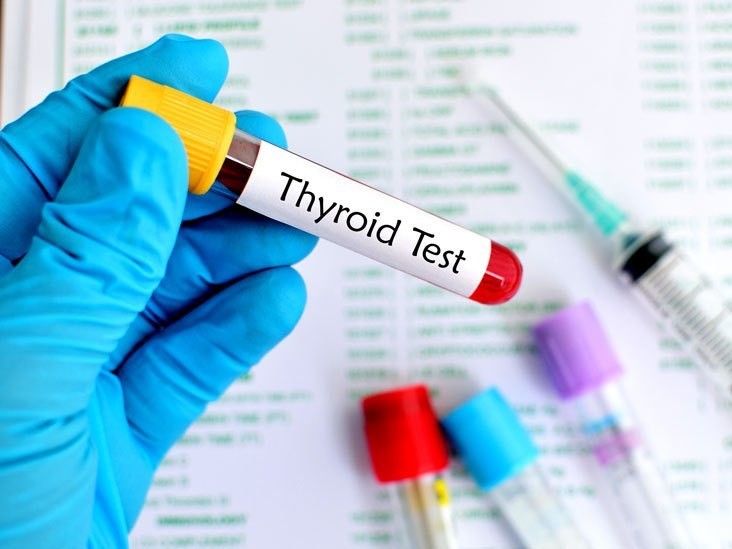 Interpretation of Thyroid Function Tests